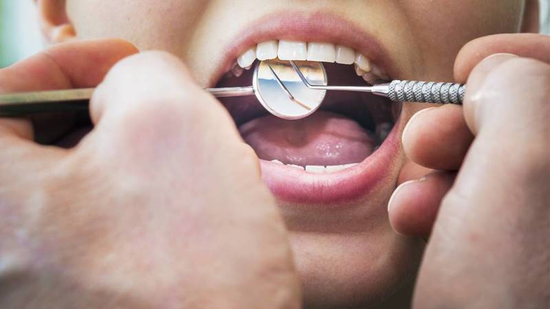 آفات الأسنان تتلف طبقة المينا وتكشف ل ب السن صحيفة الخليج